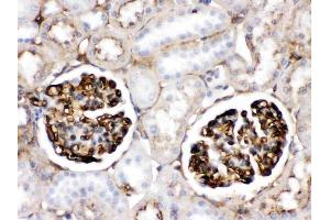 IHC analysis of APOA1 using anti-APOA1 antibody (ABIN3044502).