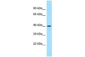 Host: Rabbit Target Name: OR52A5 Sample Type: Placenta lysates Antibody Dilution: 1. (OR52A5 Antikörper  (C-Term))