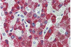 Human Liver: Formalin-Fixed, Paraffin-Embedded (FFPE)