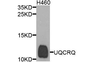 Western blot analysis of extracts of H460 cells, using UQCRQ antibody. (UQCRQ Antikörper)