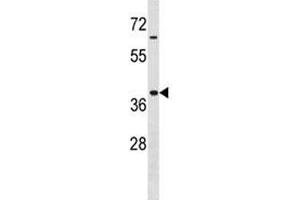 Hoxa9 antibody western blot analysis in MDA-MB453 lysate. (HOXA9 Antikörper  (AA 160-189))