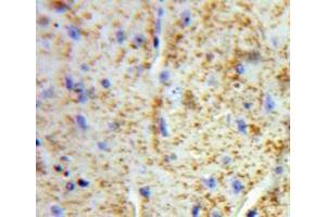 Used in DAB staining on fromalin fixed paraffin-embedded Brain tissue (VWA2 Antikörper  (AA 457-708))