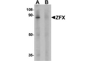 Western blot analysis of ZFX human small intestine tissue lysate with ZFX Antibody  at 1 ug/ml in (A) the absence and (B) the presence of blocking peptide. (ZFX Antikörper  (C-Term))