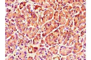 Immunohistochemistry of paraffin-embedded human pancreatic tissue using ABIN7173407 at dilution of 1:100 (TNRC6C Antikörper  (AA 157-421))
