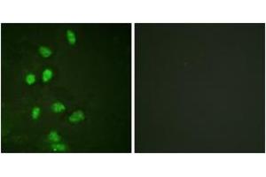 Immunofluorescence analysis of HeLa cells, using CHOP (Ab-30) Antibody. (DDIT3 Antikörper  (AA 15-64))