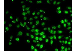 Immunofluorescence analysis of HeLa cell using GABPB1 antibody. (GABPB1 Antikörper)
