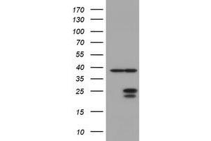Image no. 1 for anti-Ubiquitin-Conjugating Enzyme E2E 3 (UBE2E3) antibody (ABIN1501623) (UBE2E3 Antikörper)