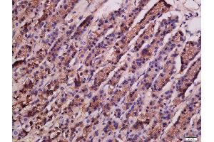 Formalin-fixed and paraffin embedded rat stomach labeled with Rabbit Anti-ATG9A Polyclonal Antibody, Unconjugated  at 1:200 followed by conjugation to the secondary antibody and DAB staining (ATG9A Antikörper  (AA 301-400))