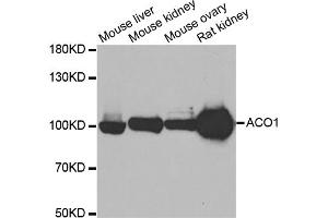 Western blot analysis of extracts of various cell lines, using ACO1 antibody (ABIN5973578) at 1/500 dilution. (Aconitase 1 Antikörper)