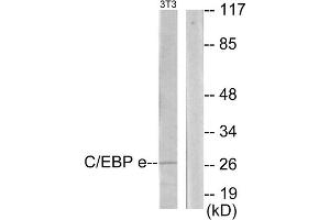 Western blot analysis of extracts from NIH-3T3 cells, using C/EBP epsilon antibody. (CEBPE Antikörper  (C-Term))