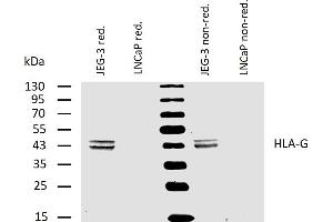 Western blotting analysis of human HLA-G using mouse monoclonal antibody MEM-G/4 on lysates of JEG-3 cell line and LNCaP cell line (negative control) under reducing and non-reducing conditions. (HLAG Antikörper)