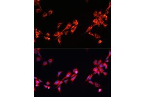 Immunofluorescence analysis of NIH/3T3 cells using PGRMC2 antibody (ABIN7269534) at dilution of 1:100.