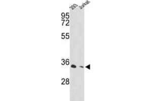Western Blotting (WB) image for anti-Proteasome (Prosome, Macropain) 26S Subunit, Non-ATPase, 11 (PSMD11) antibody (ABIN3001640) (PSMD11 Antikörper)
