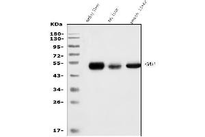 Western blot analysis of SHMT1 using anti-SHMT1 antibody (ABIN7599420).