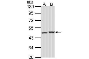 Western Blotting (WB) image for anti-Proteasome (Prosome, Macropain) 26S Subunit, ATPase, 5 (PSMC5) (Center) antibody (ABIN2856087)