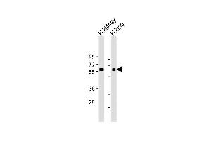 All lanes : Anti-MKS1 Antibody (N-Term) at 1:2000 dilution Lane 1: Human kidney lysate Lane 2: Human lung lysate Lysates/proteins at 20 μg per lane. (MKS1 Antikörper  (AA 90-124))