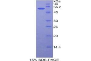 SDS-PAGE analysis of Human ADA Protein. (ADA Protein)