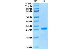 WFDC1 Protein (AA 32-192) (His tag)