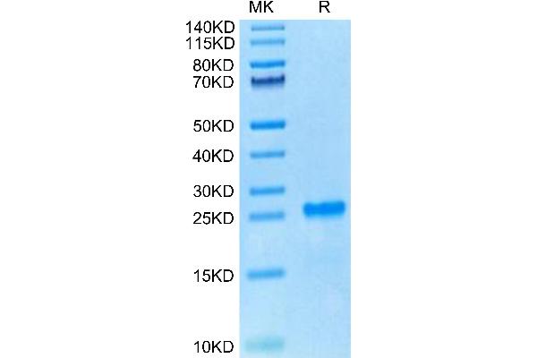 WFDC1 Protein (AA 32-192) (His tag)
