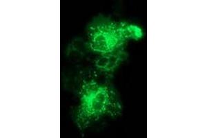 Anti-MMAB mouse monoclonal antibody (ABIN2454036) immunofluorescent staining of COS7 cells transiently transfected by pCMV6-ENTRY MMAB (RC204290). (MMAB Antikörper)