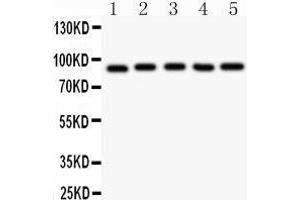 Western Blotting (WB) image for anti-Aryl Hydrocarbon Receptor Nuclear Translocator (ARNT) (AA 416-789) antibody (ABIN3043528) (ARNT Antikörper  (AA 416-789))