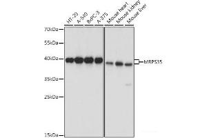 Western blot analysis of extracts of various cell lines using MRPS35 Polyclonal Antibody at dilution of 1:1000. (MRPS35 Antikörper)