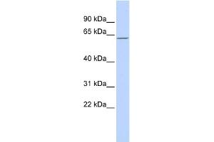 WB Suggested Anti-MBD4 Antibody Titration:  0.
