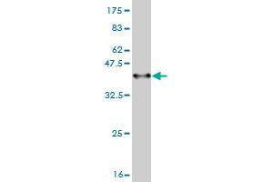 Western Blot detection against Immunogen (36. (ADAM17 Antikörper  (AA 215-314))