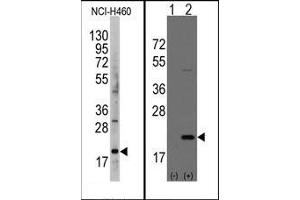 Image no. 1 for anti-Anterior Gradient Homolog 2 (Xenopus Laevis) (AGR2) (AA 102-132) antibody (ABIN358784) (AGR2 Antikörper  (AA 102-132))