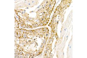 Immunohistochemistry (IHC) image for anti-Adaptor-Related Protein Complex 3, beta 1 Subunit (AP3B1) (AA 895-1094) antibody (ABIN6136962)