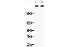 Western Blotting (WB) image for anti-Plectin (PLEC) (AA 2644-2671), (Middle Region) antibody (ABIN3043900) (PLEC Antikörper  (Middle Region))