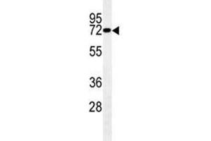 Western Blotting (WB) image for anti-LIM Domain Kinase 1 (LIMK1) (AA 479-508) antibody (ABIN3028800)