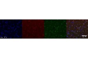 Immunohistochemistry (IHC) image for anti-Nuclear Receptor Subfamily 4, Group A, Member 2 (NR4A2) antibody (ABIN7456241) (NR4A2 Antikörper)
