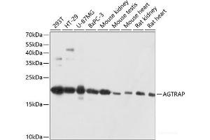 Western blot analysis of extracts of various cell lines using AGTRAP Polyclonal Antibody at dilution of 1:3000.