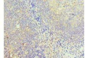 Immunohistochemistry of paraffin-embedded human tonsil tissue using ABIN7149352 at dilution of 1:100 (NCK1 Antikörper  (AA 58-377))