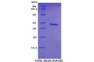 SDS-PAGE analysis of Mouse Cytochrome P450 26A1 Protein.