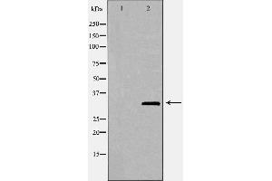 Western blot analysis of Hela whole cell lysates, using FBL Antibody. (Fibrillarin Antikörper  (Internal Region))