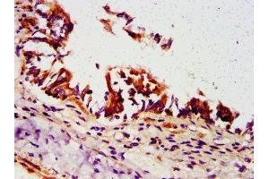 IHC image of ABIN7162284 diluted at 1:500 and staining in paraffin-embedded human lung tissue performed on a Leica BondTM system. (ORMDL3 Antikörper  (AA 43-94))