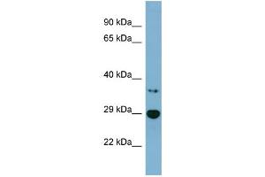 WB Suggested Anti-BDH2 Antibody Titration: 0.