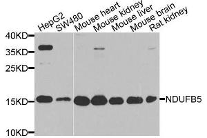 Western blot analysis of extracts of various cell lines, using NDUFB5 antibody. (NDUFB5 Antikörper  (AA 100-189))