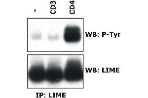 Induction of LIME tyrosine phosphorylation. (LIME Antikörper  (AA 141-295))