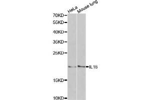 Western blot analysis of extracts of various cell lines, using IL18 antibody. (IL-18 Antikörper)