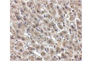 Immunohistochemistry (Paraffin-embedded Sections) (IHC (p)) image for anti-Albumin (ALB) (Center) antibody (ABIN783576)