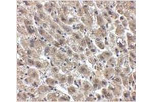 Immunohistochemistry of Albumin in human liver tissue with Albumin antibody at 2. (Albumin Antikörper  (Center))