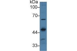 Western Blotting (WB) image for anti-Protein Phosphatase, Mg2+/Mn2+ Dependent, 1A (PPM1A) (AA 2-382) antibody (ABIN7441469)