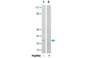 Western blot analysis of extracts from HUVEC cells, using IGFBP3 polyclonal antibody . (IGFBP3 Antikörper  (Ser183))