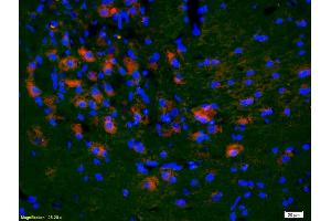 Formalin-fixed and paraffin-embedded rat brain labeled with Anti-KLF5/UKHC Polyclonal Antibody, Unconjugated (ABIN739515) 1:200, overnight at 4°C, The secondary antibody was Goat Anti-Rabbit IgG, Cy3 conjugated used at 1:200 dilution for 40 minutes at 37°C.