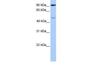 WB Suggested Anti-STAT5B Antibody Titration: 1 ug/ml Positive Control: Fetal Brain Lysate (STAT5B Antikörper  (C-Term))