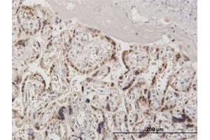 Immunohistochemistry (Formalin-fixed Paraffin-embedded Sections) (IHC (fp)) image for anti-Ran GTPase Activating Protein 1 (RANGAP1) (AA 1-587) antibody (ABIN519631)