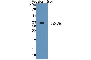 Western blot analysis of the recombinant protein. (PLCH1 Antikörper  (AA 1-237))